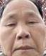 小太阳3